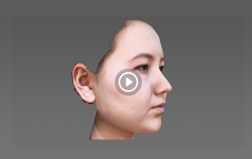 面部三維掃描儀,3D臉部三維掃描儀,人臉三維掃描整形,3D數(shù)字整形,面部3D填充整形,頜面外科整形,3D智能面部掃描系統(tǒng)