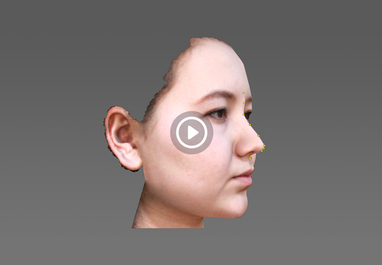 面部三維掃描儀,面部醫(yī)美整形,顱頜面整形_領(lǐng)智三維