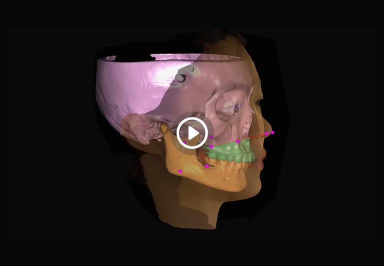 面部三維掃描儀,面部醫(yī)美整形,顱頜面整形_領(lǐng)智三維