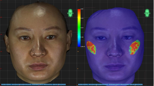 領(lǐng)智三維助力西安交大一附院整形美容頜面外科實(shí)現(xiàn)數(shù)字化微整形