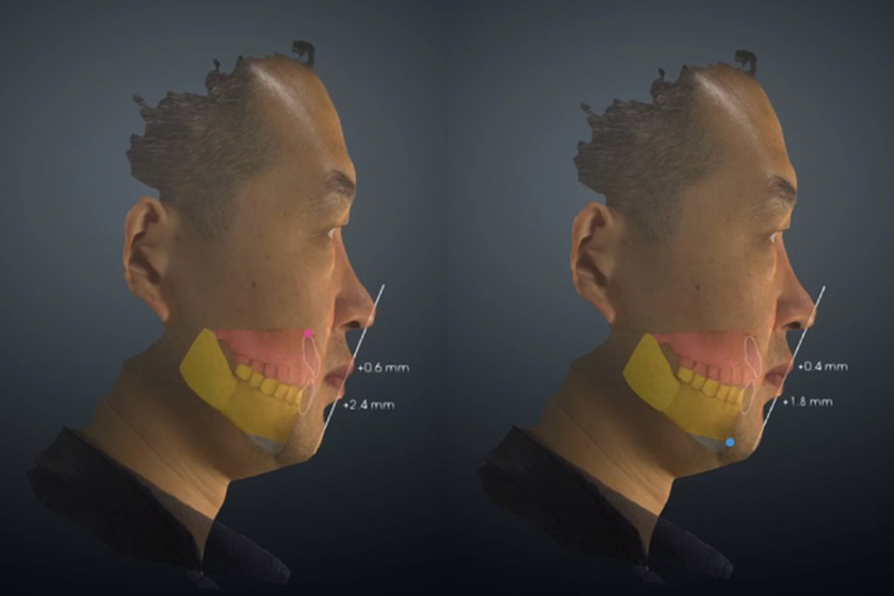 數(shù)字化技術(shù)賦能口腔正畸正頜，領(lǐng)智三維參展2024合肥口腔展